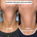 SilkGlide Pro™ – Épilateur visage 2-en-1 pour une peau lisse et douce