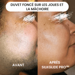 SilkGlide Pro™ – Épilateur visage 2-en-1 pour une peau lisse et douce
